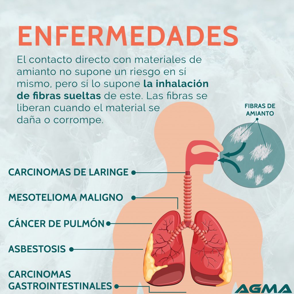 Enfermedades relacionadas con el amianto